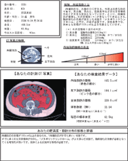 CT内臓脂肪計測